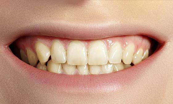 치아 변색 예방을 위해서는 색소가 강한 음식과 음료를 줄이는 것이 가장 좋다./사진=클립아트코리아