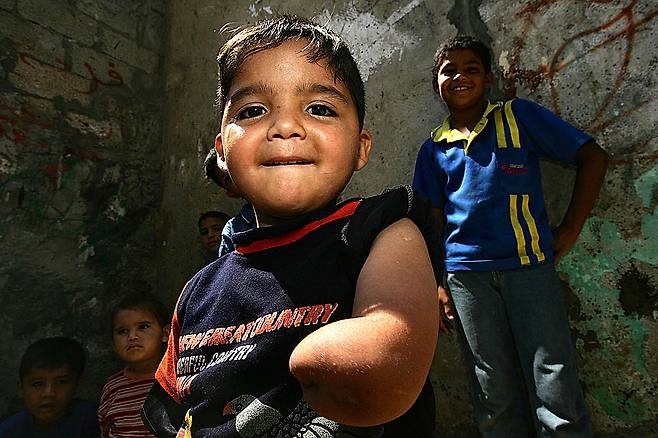 이스라엘군 탱크 포격으로 팔 일부를 잃은 팔레스타인 소년. 게티이미지