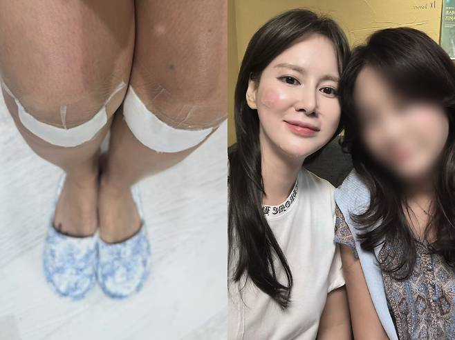 이혜원이 낙상사고를 당했다. 인스타그램 캡처.