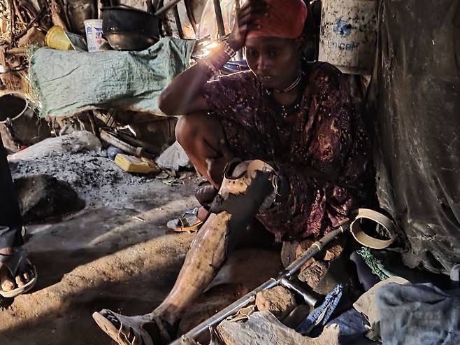 메이싼은 다리 암으로 한쪽 다리를 절단했지만 현재는 한국교회의 후원으로 이뤄진 과부 사역을 통해 플라스틱 의족을 하고 있다.