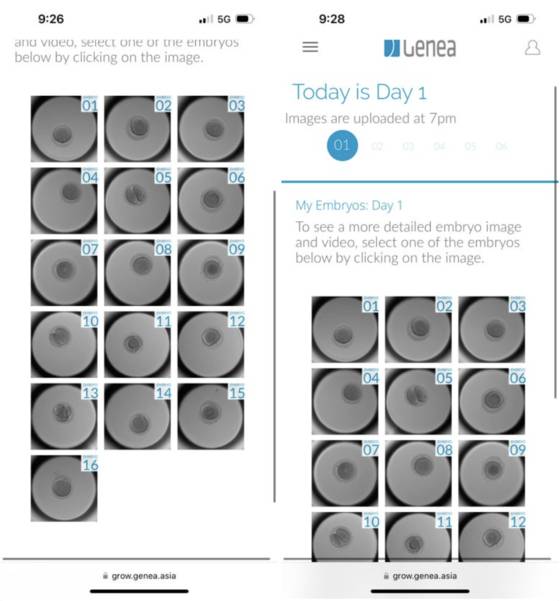 The image shows how Sohan's fertilized embryos were incubated. [SOHAN]