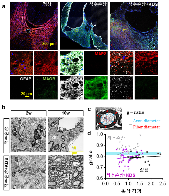 척수손상 동물모델에서 KDS2010 투여는 손상으로 과도하게 증가한 별세포(astrocyte) 내 MAOB 발현을 억제했고, 신경세포 표지 단백질인 MAP2 발현을 회복시켜 손상 부위 신경세포가 보존되는 효과를 보였다(a). 또한 전자현미경 관찰에서는 손상으로 파괴된 수초화 축삭이 정상 구조에 가깝게 회복됐으며(b-c), g-ratio(수초 두께를 나타내는 지표) 분석에서도 얇아졌던 수초가 유의미하게 두꺼워진 것이 확인됐다(d). IBS