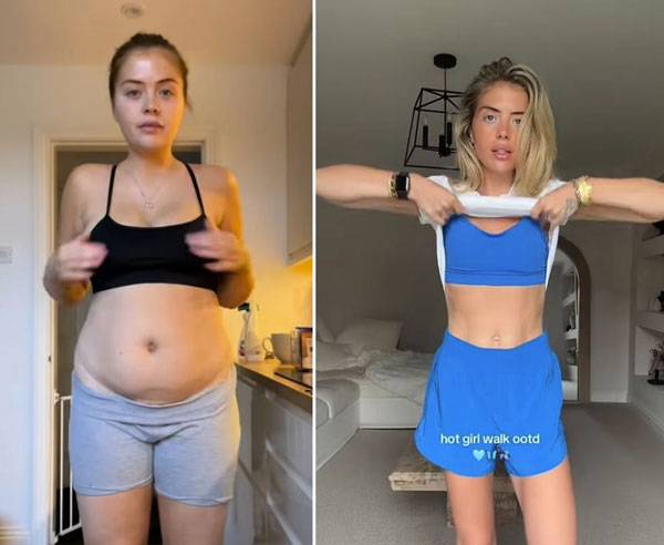 베다니 켄드라의 다이어트 전(왼)과 후(오)의 모습./사진=데일리메일