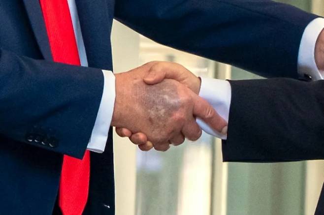 백악관에 도착한 이재명 대통령과 악수하는 도널드 트럼프 대통령의 손이 멍들어있다. AP연합뉴스