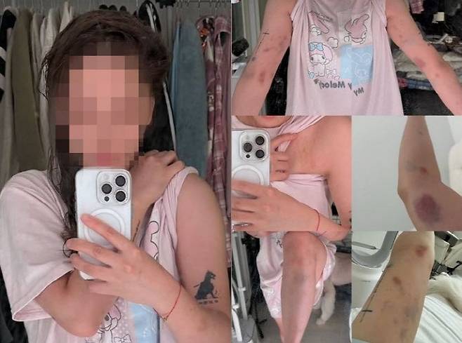 서울 홍대거리에서 성적 제안을 받은 뒤 폭행을 당했다는 대만 여성의 사연이 전해졌다. (사진=SNS 캡처)