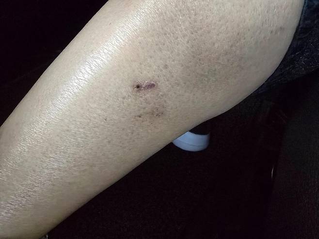 (보배드림 갈무리)