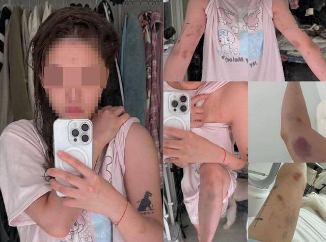 대만인 여성이 서울 마포구 홍대에서 중국 국적 남성들한테 폭행당하는 사건이 발생했다. A씨 사회관계망서비스(SNS) 캡처