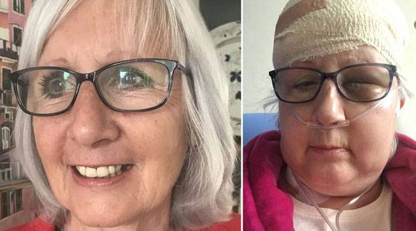 영국 여성 릴리는 67세였을 당시 뇌종양으로 집에서 쓰러졌다 깨어난 후 자신을 41세로 착각하는 증상을 겪었다. 알고 보니 뇌종양 때문으로 밝혀져 수술을 받았다. 오른쪽 사진은 수술 후 릴리의 모습. /사진=더 미러