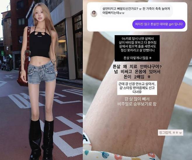 최준희가 튼살을 공개했다. 사진=최준희 인스타그램