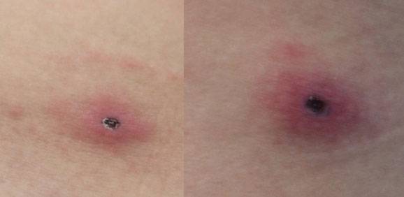 대한감염학회 학술지