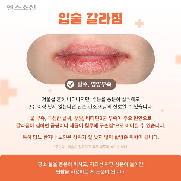 사진=헬스조선DB