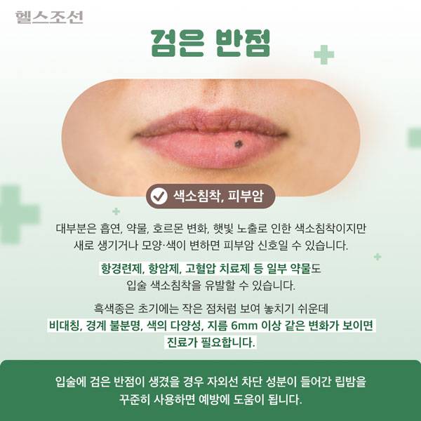 사진=헬스조선DB