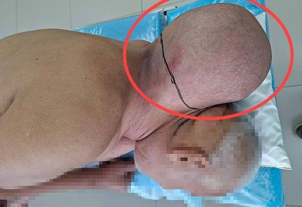 사진=키로프 주립 임상병원