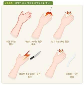 복합부위통증증후군이 있으면 심한 통증 양상이 나타난다. 보건복지부 제공