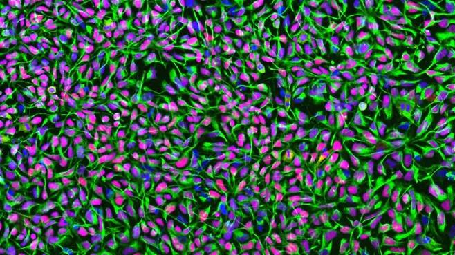 배양 중인 인간신경줄기세포 이미지. 취리히대학교 제공