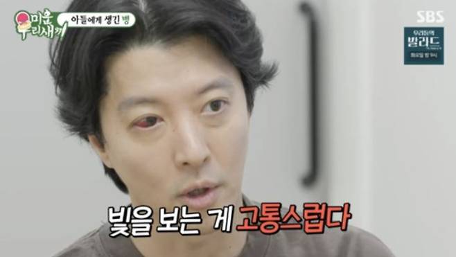 이동건이 강직성 척추염 진단을 받았다. 사진=SBS 예능 프로그램 '미운 우리 새끼' 방송화면 캡처