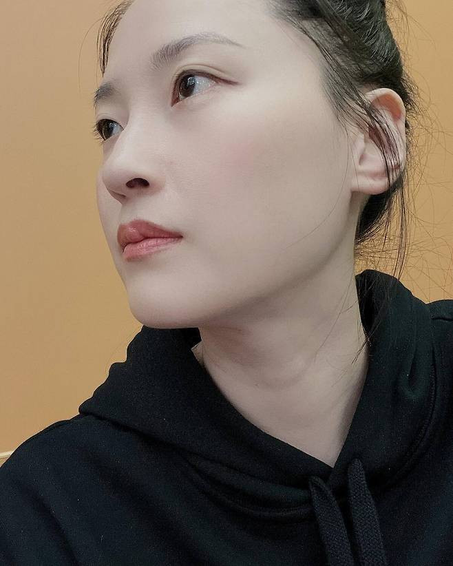 점 제거 시술로 화제를 모았던 혜박. 혜박 SNS 캡처