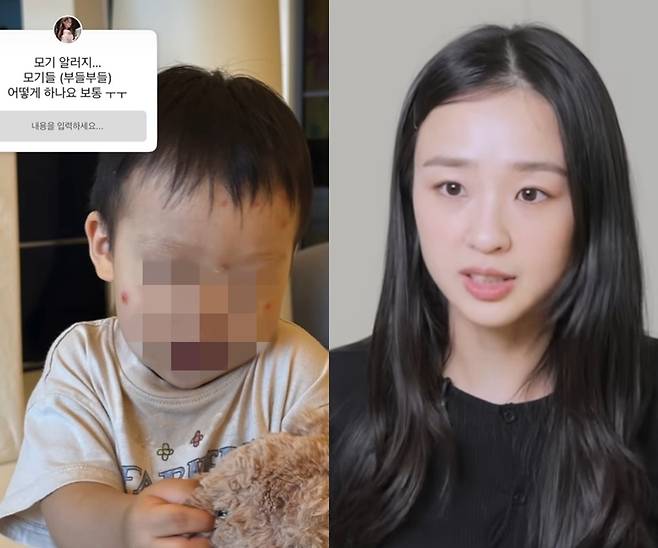 전 리듬체조선수 손연재가 아들이 모기 알레르기 ‘스키터 증후군’으로 심한 부종과 염증을 겪은 사연을 공개했다. 사진=손연재 유튜브