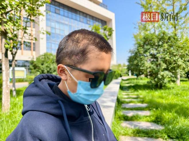 곰에게 공격받았으나 죽은 척해 살아남은 중국의 한 임산부. 그녀와 그녀의 남편은 태아가 가장 걱정이라고 했다. /극목신문 캡처