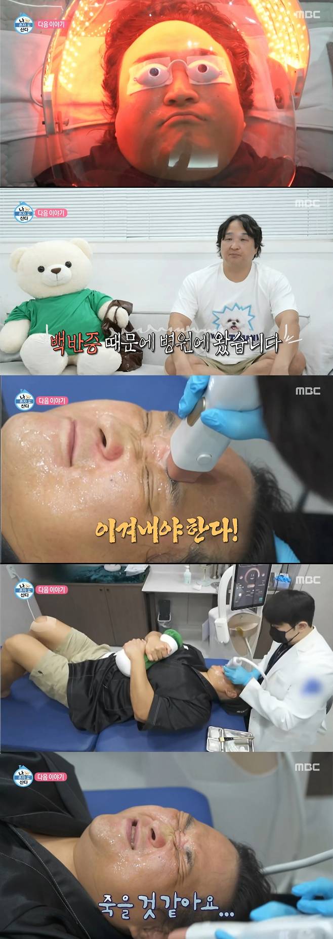 백반증 치료를 받는 구성환. /사진=MBC '나 혼자 산다' 캡처