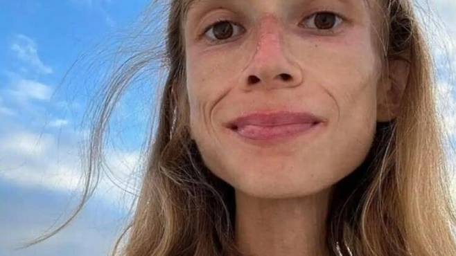 극단적인 '프루테리언(fruitarian)' 식단을 수년간 이어온 20대 폴란드 여성이 인도네시아 발리의 리조트에서 숨진 채 발견됐다. 사진=캐롤리나 크르지자크 SNS