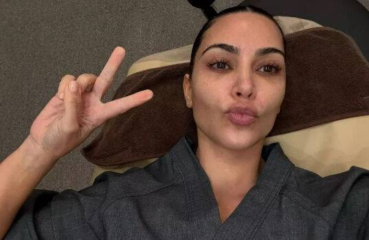 한국에서 피부시술을 받은 킴 카다시안./소셜미디어