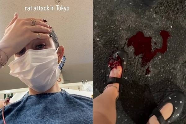 일본 대표 여행지로 꼽히는 수도 도쿄에서 길거리를 걷던 한 외국인 관광객이 쥐에게 물려 다쳤다는 주장이 나와 눈길을 끌고 있다. 〈사진=인스타그램 캡처〉
