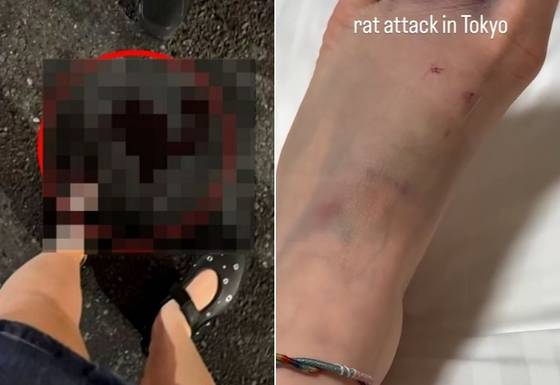 한 여행객이 지난 9일 도쿄 신주쿠 거리에서 쥐에 발을 물리는 사고를 당했다. 사진 인스타그램 yogitutty 캡처
