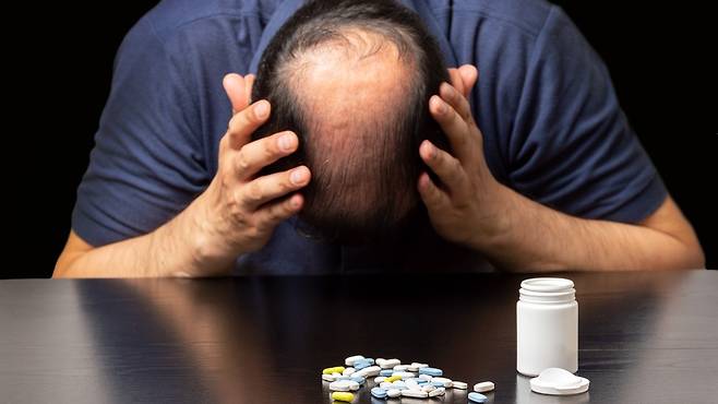 탈모 치료제로 사용돼온 '피나스테리드'의 정신 질환 유발 가능성이 재조명됐다｜출처: 게티이미지뱅크