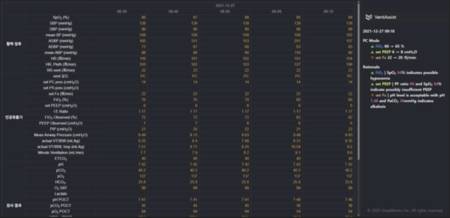 딥메트릭스의 밴트 어시스트 솔루션 화면/사진제공=딥메트릭스