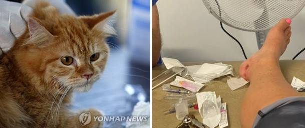 길고양이에게 물려 공수병으로 치료  (고양이 사진은 실제 사건과 무관) [연합뉴스, 뉴욕포스트]