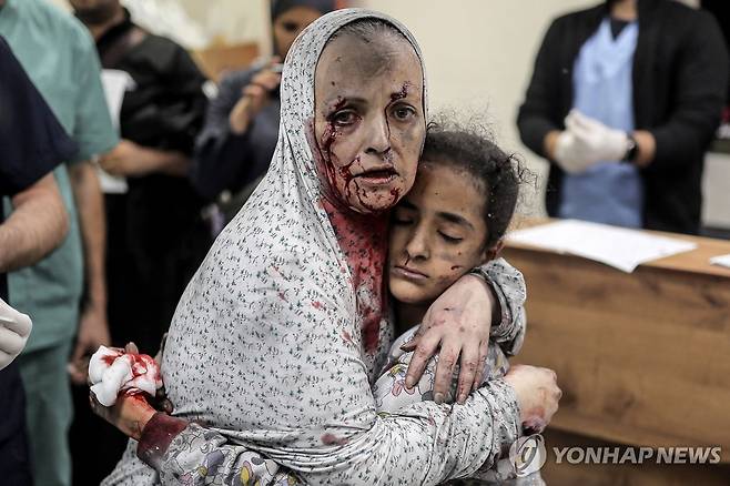 가자지구 부상자 (칸유니스 AFP=연합뉴스) 지난 15일(현지시간) 가자지구 남부 칸유니스의 한 병원에 한 여성이 다친 아이를 끌어안고 있다. 2025.10.17 photo@yna.co.kr