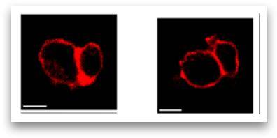 ▲그림3 면역시냅스가 생기는 정도를 나타내는 사진. 원 모양 두 개 중에서 큰 원이 종양세포, 조금 작은 원이 T세다. 왼쪽 사진은 일반 쥐이고, T세포가 종양세포와 결합해 면역 시냅스를 단단하게 형성했다. 오른쪽은 T세포에 CD99 유전자가 없는 생쥐 사진. 이 경우에는 T세포가 종양세포를 공격하기 위해 면역시냅스를 활발하게 만들지 못한다. 두 세포의 밀착 부위에 면역시냅스가 약하게 형성되어 있다. ⓒ이미지 최은영 교수 제공