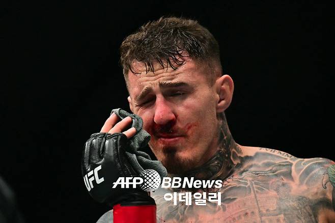 UFC 헤비급 챔피언 톰 아스피날이 시릴 간과으 타이틀전 도중 손가락에 눈을 찔린 뒤 고통스러워 하고 있다. 사진=UFC
