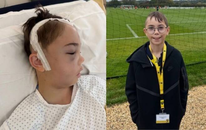 하루 아침에 오른쪽 눈이 안보이게 된 소년의 사연이 전해졌다. 아무 이상 증상도 없던 아이는 시력을 잃은 뒤 반년 만에 '신경초종' 진단을 받았다. 사진=고펀드미