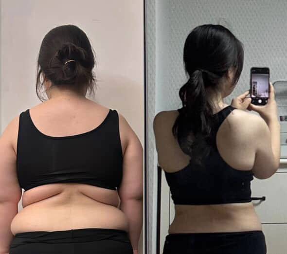 다이어트 전(왼)과 후(오) 조유진씨의 모습./사진=조유진씨 제공