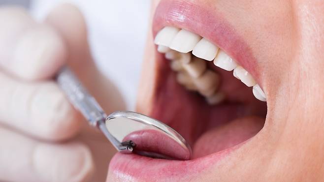 임플란트가 불가능할 때 브릿지나 틀니 치료로 치아 기능을 회복할 수 있다｜출처: 클립아트코리아