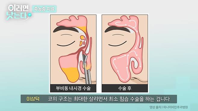 /조선일보 의학·건강 유튜브 '이러면 낫는다'