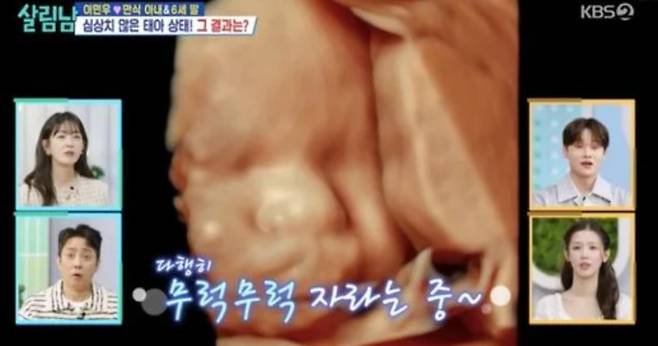 '살림남2' 이민우♥아미, 태아 초음파 사진
