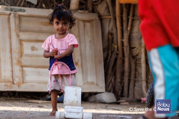 불발탄 폭발로 손 일부를 잃은 예멘의 2세 아동. ⓒ세이브더칠드런