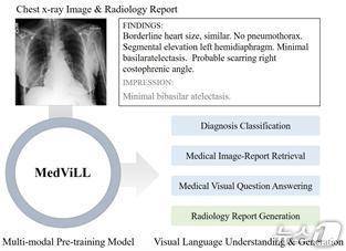 엑스레이 이미지와 의사 판동문(텍스트)을 함께보며 AI훈련시키는 과정(KAIST 제공) /뉴스1