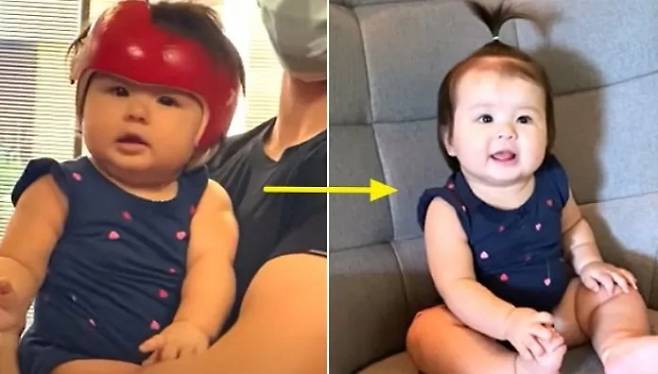 3개월 만에 교정헬멧을 벗은 체리의 모습. 유튜버 올리버쌤 캡처.