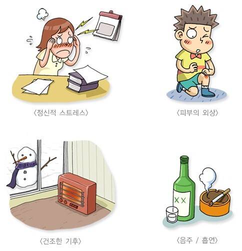 건선을 악화시키는 환경적 요인들. 국가건강정보포털