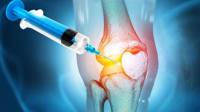 골다공증은 주사 치료와 생활 요법을 병행하는 것이 핵심이다｜출처: 게티이미지뱅크