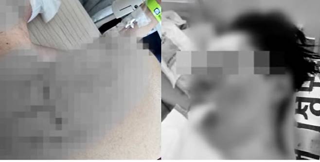 송도서 납치돼 무차별 폭행을 당한 100만 유튜버 수탉의 피해 사진./JTBC  '사건반장'