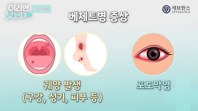 /조선일보 의학·건강 유튜브 '이러면 낫는다'