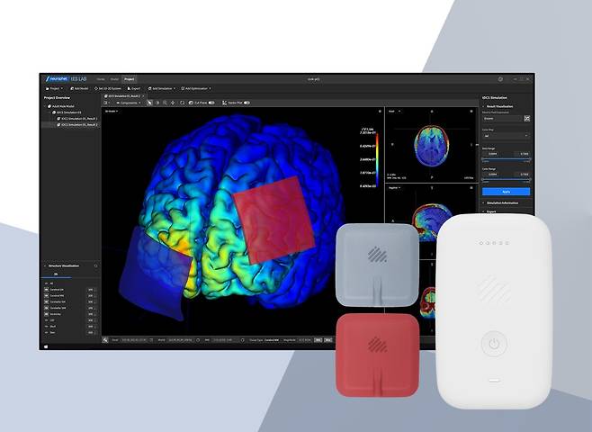 개인 맞춤형 'AI tDCS 솔루션' 활용 모습.(뉴로핏 제공)/뉴스1