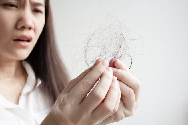 겨울철에 다른 사람과 모자를 함께 썼다간 두피 백선에 감염될 수 있다는 경고가 나왔다. 게티이미지뱅크