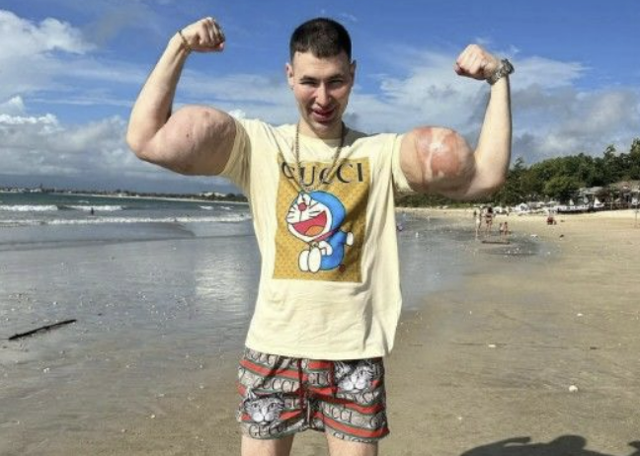 러시아 종합격투기 선수 키릴 테레신(29). [인스타그램 갈무리]