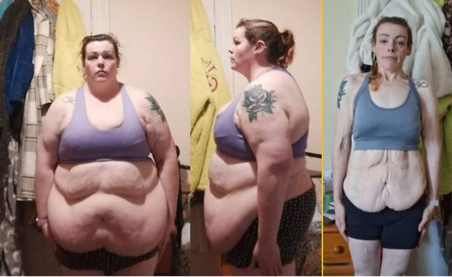 감정 기복을 음식으로 달래며 한때 체중이 약 140kg까지 불어났던 한 여성이, 식단 조절과 규칙적인 운동만으로 86kg을 감량하는 데 성공했다는 사연이 공유됐다. 사진=고펀드미
